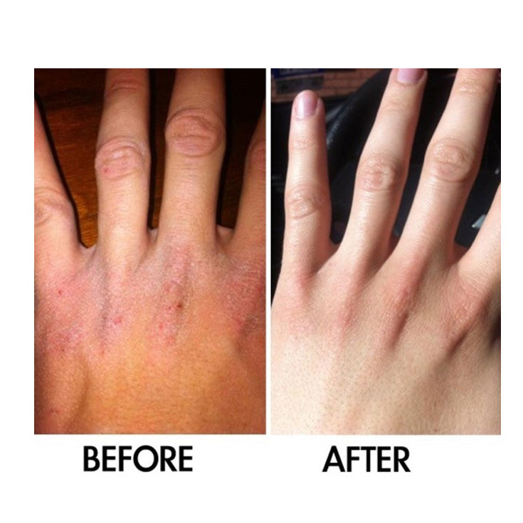 SkinSanity® Intensive Body Lotion, 3.38 fl oz